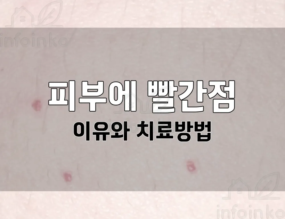 피부에 갑자기 생긴 빨간점은 뭘까? 이유와 없애는 방법.